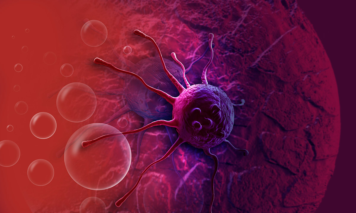 LIGHT SCATTERING TOOL HELPS DOCTORS IDENTIFY EARLY PANCREATIC CANCER