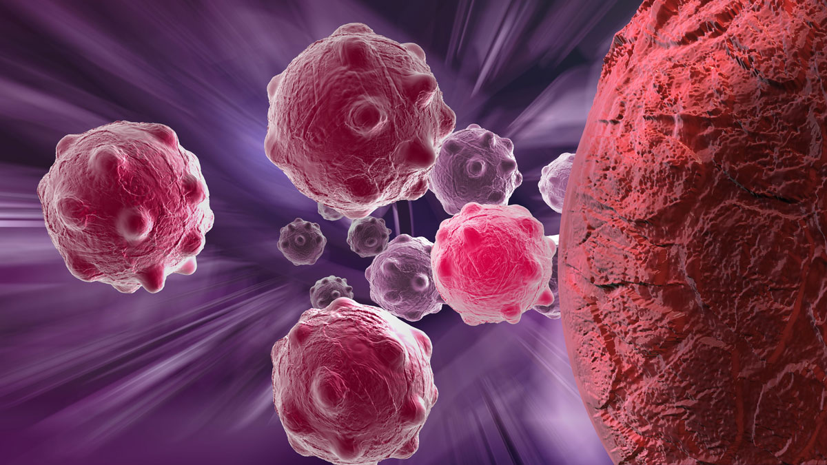 Baylor Scott & White Research Institute and TGen Are Poised To Create An Early Detection Test For Pancreatic Cancer
