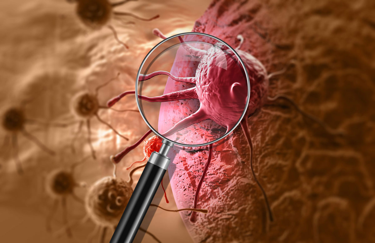 NEW TREATMENT STUDY TRIGGERS SELF-DESTRUCTION OF PANCREATIC CANCER CELLS IN MICE